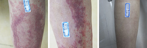 ���ݷ���Ƥ����ҽԺ