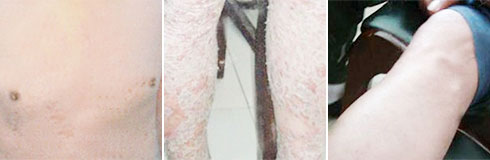 ���ݷ���Ƥ����ҽԺ