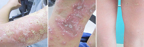 ���ݷ���Ƥ����ҽԺ