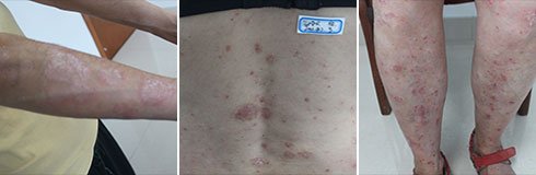 ���ݷ���Ƥ����ҽԺ