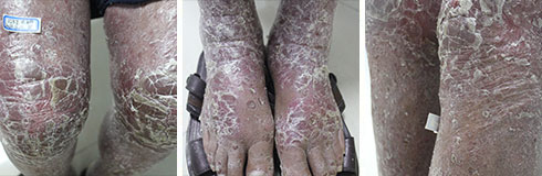 ���ݷ���Ƥ����ҽԺ