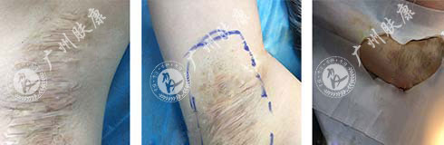 ���ݷ���Ƥ����ҽԺ