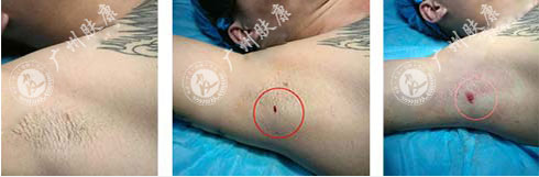 ���ݷ���Ƥ����ҽԺ