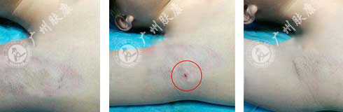 ���ݷ���Ƥ����ҽԺ