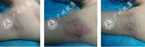 ���ݷ���Ƥ����ҽԺ