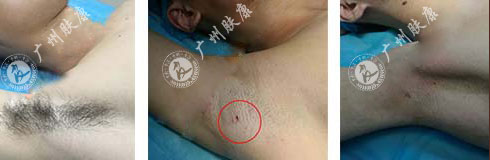 ���ݷ���Ƥ����ҽԺ