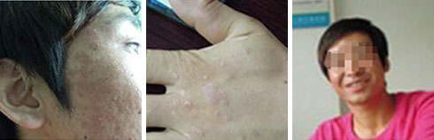 ���ݷ���Ƥ����ҽԺ