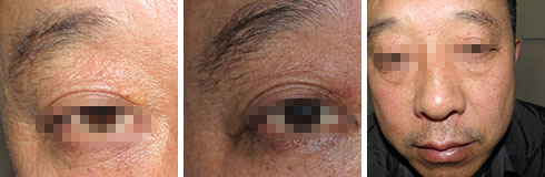 ���ݷ���Ƥ����ҽԺ