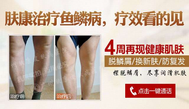 ���ݷ���Ƥ����ҽԺ