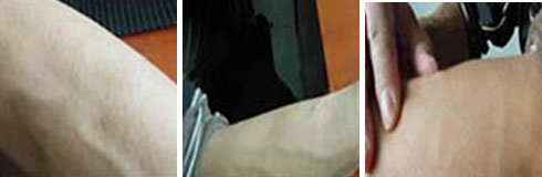 ���ݷ���Ƥ����ҽԺ