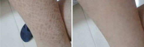 ���ݷ���Ƥ����ҽԺ