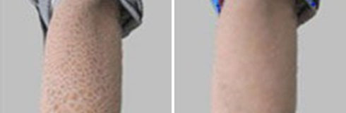 ���ݷ���Ƥ����ҽԺ