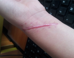 ���ݷ���Ƥ����ҽԺ