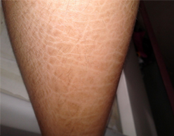 ���ݷ���Ƥ����ҽԺ