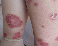 ���ݷ���Ƥ����ҽԺ