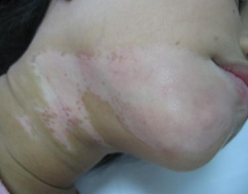 ���ݷ���Ƥ����ҽԺ