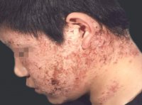 ���ݷ���Ƥ����ҽԺ