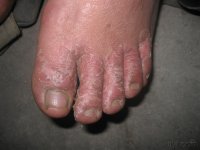 ���ݷ���Ƥ����ҽԺ