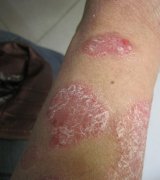 ���ݷ���Ƥ����ҽԺ