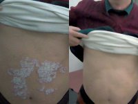 ���ݷ���Ƥ����ҽԺ