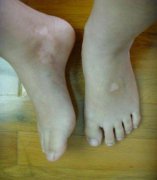 ���ݷ���Ƥ����ҽԺ