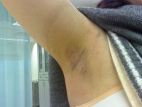 ���ݷ���Ƥ����ҽԺ