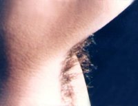 ���ݷ���Ƥ����ҽԺ