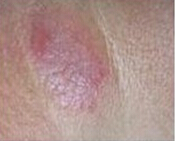 ���ݷ���Ƥ����ҽԺ