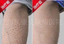 ���ݷ���Ƥ����ҽԺ