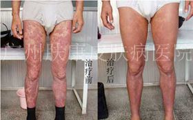 ���ݷ���Ƥ����ҽԺ