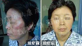 ���ݷ���Ƥ����ҽԺ