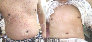 ���ݷ���Ƥ����ҽԺ