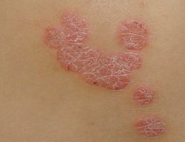 ���ݷ���Ƥ����ҽԺ