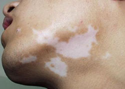 ���ݷ���Ƥ����ҽԺ