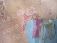 ���ݷ���Ƥ����ҽԺ