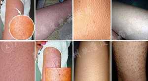 ���ݷ���Ƥ����ҽԺ