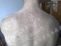 ���ݷ���Ƥ����ҽԺ