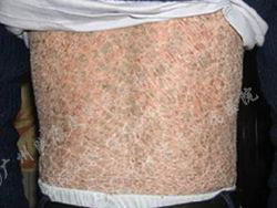 ���ݷ���Ƥ����ҽԺ