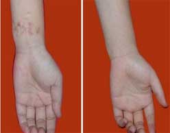 ���ݷ���Ƥ����ҽԺ