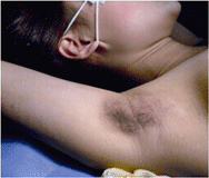 ���ݷ���Ƥ����ҽԺ