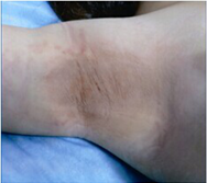 ���ݷ���Ƥ����ҽԺ