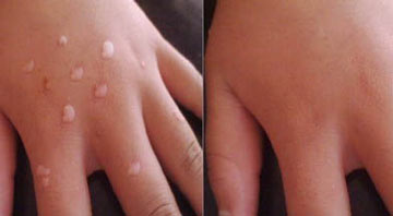 ���ݷ���Ƥ����ҽԺ