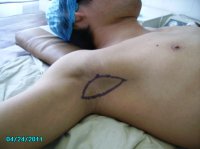 广州肤康皮肤病医院