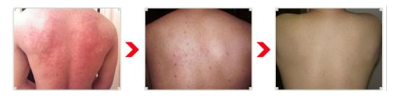 ���ݷ���Ƥ����ҽԺ