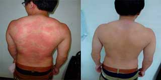 ���ݷ���Ƥ����ҽԺ