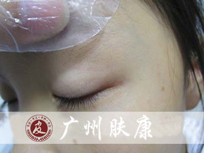 广州肤康皮肤病医院