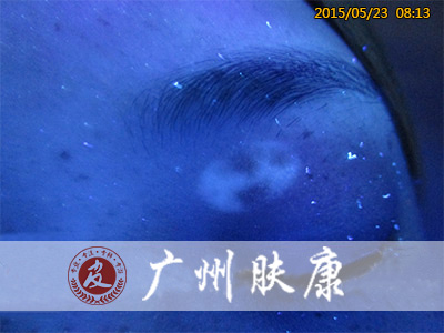 ���ݷ���Ƥ����ҽԺ