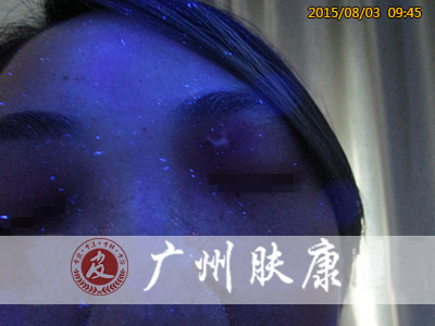 ���ݷ���Ƥ����ҽԺ