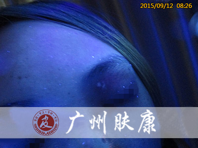 ���ݷ���Ƥ����ҽԺ