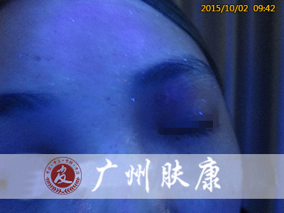 ���ݷ���Ƥ����ҽԺ